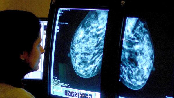 筛查服务机构向蒂珀雷里死于乳腺癌的妇女的家人道歉